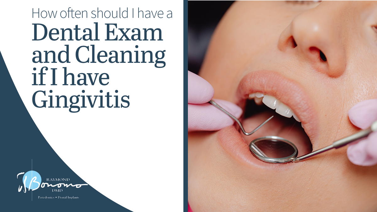 Dental exam. The text reads, "How Often Should I Have a Dental Exam and Cleaning if I Have Gingivitis?"